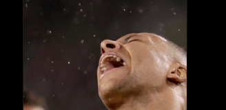 Kylian Mbappe i jego ''ZĄB'' po niedawnym zabiegu!